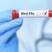 কানাডায় প্রথম এইচ৫ বার্ড ফ্লু আক্রান্ত রোগী শনাক্ত